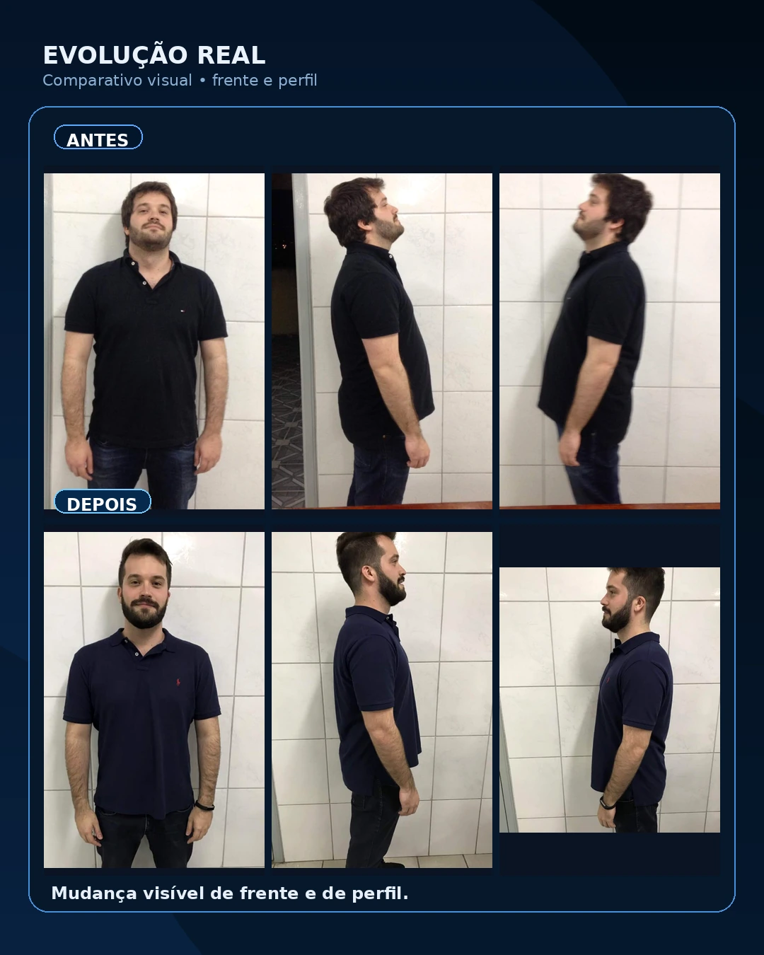 Prova social RJ Performance com comparativo visual de frente e perfil antes e depois
